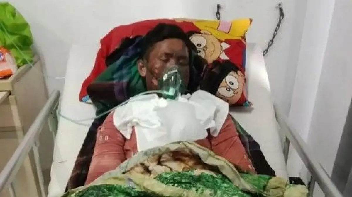 Cekcok Pakan Sapi Berujung Maut, Pemuda Sumbawa Tewas Usai Dibakar Ibu Kandung