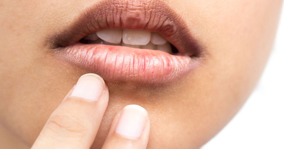 Rahasia Bibir Cerah Alami: Panduan Lengkap Mengatasi Warna Gelap dan Mencegahnya Kambuh